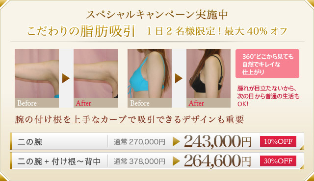 スペシャルキャンペーン実施中