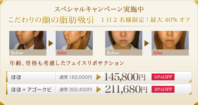 スペシャルキャンペーン実施中