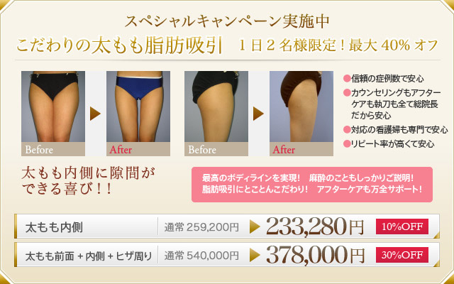 スペシャルキャンペーン実施中