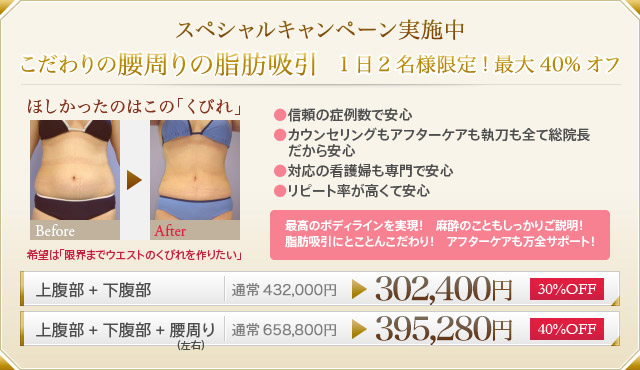 スペシャルキャンペーン実施中