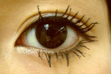 目頭切開 数種類の術式 目の手術 院長 内浦康信ブログ 脂肪吸引ならクリニック日比谷 目頭切開 数種類の術式 目の手術 院長 内浦康信ブログ 脂肪吸引ならクリニック日比谷