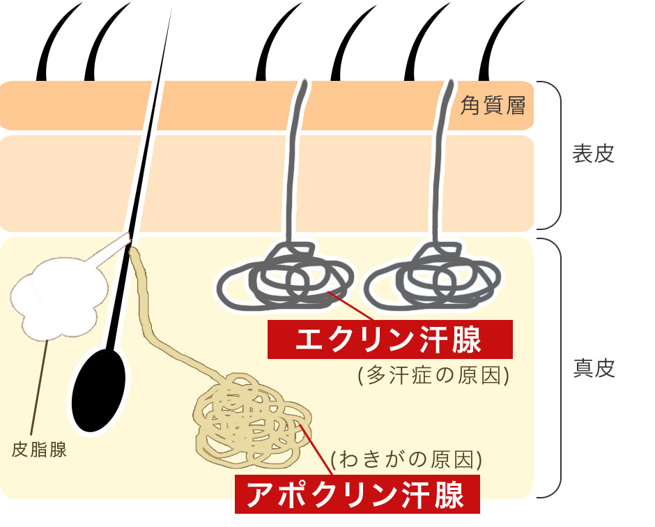 脇汗の説明_ボトックス