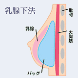 乳腺下法