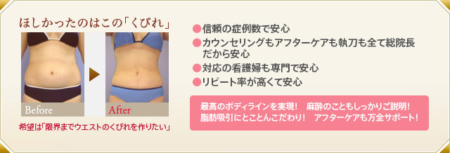 ウェストのくびれのビフォーアフター