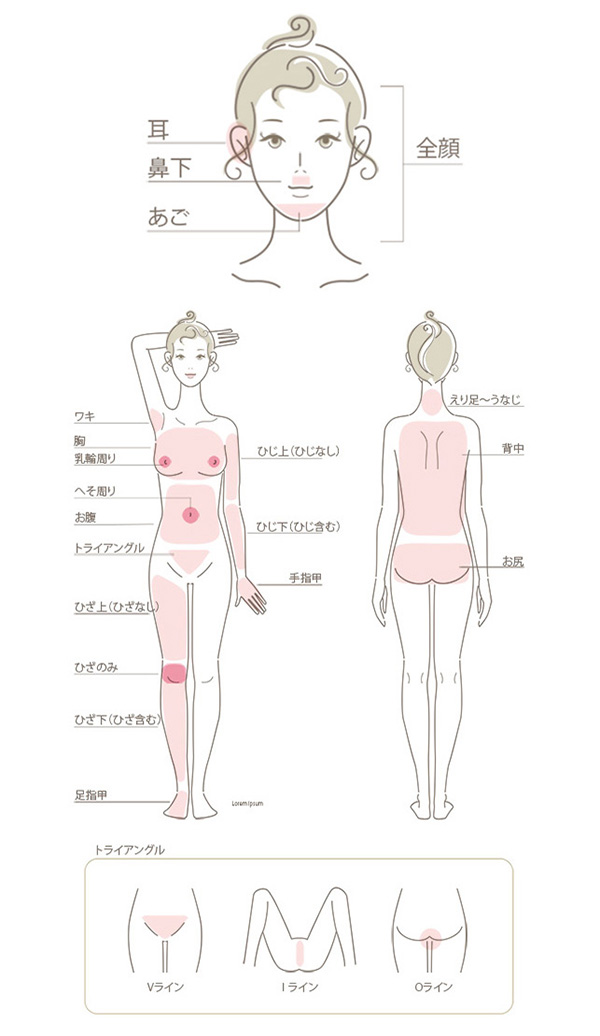 医療レーザー脱毛参考図