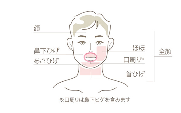 医療レーザー脱毛参考図